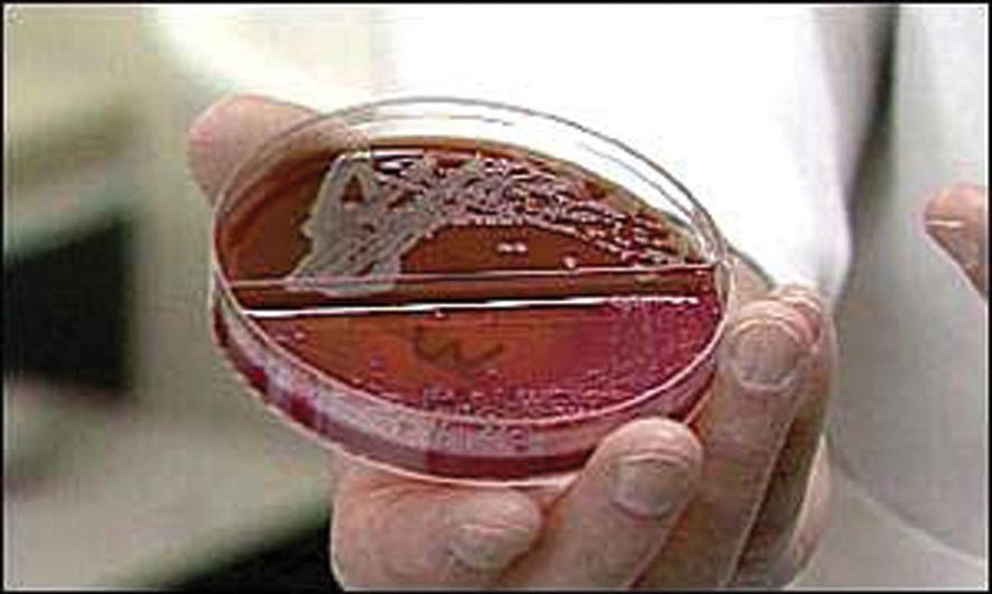 LEGIONELLA
