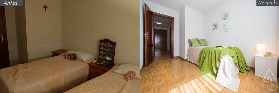 Antes-después