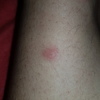 Fumigación o Desinsectación