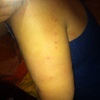 Presupuesto exterminación plaga chinches y/o pulgas (creo)