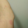 Llamar a partir de las 16hs (plaga en el dormitorio)