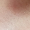 Fumigación o Desinsectación