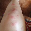 Fumigación o Desinsectación