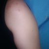Fumigación o Desinsectación