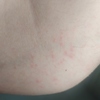 Fumigación o Desinsectación