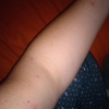 Fumigación o Desinsectación